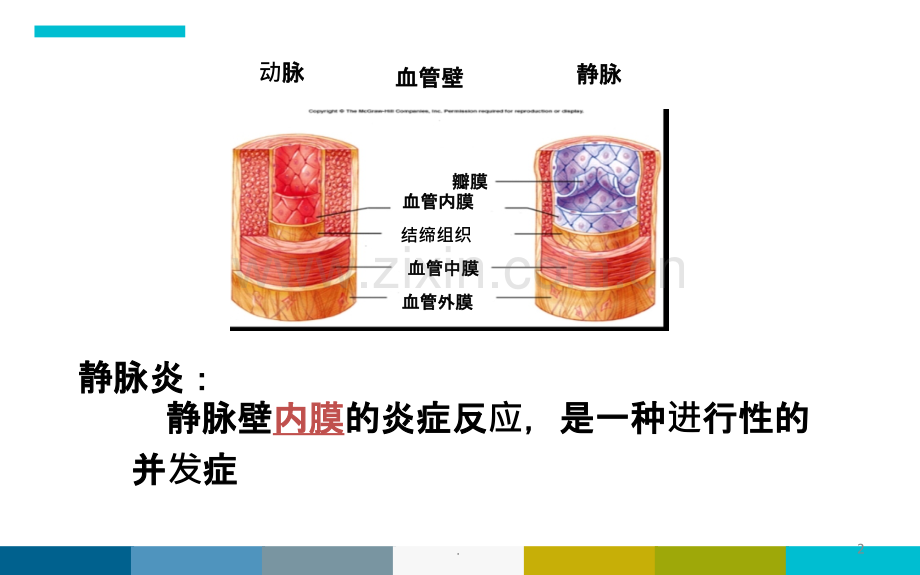 胺碘酮致静脉炎.ppt_第2页