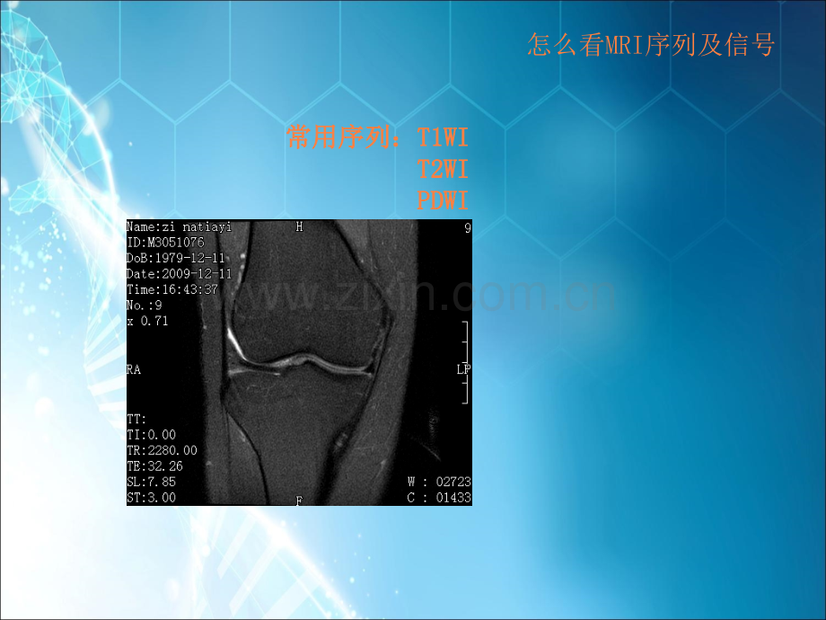 MRI诊断基础ppt课件.ppt_第2页