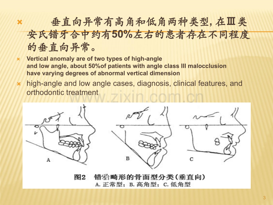 高角和低角病例的诊断、临床特征及正畸治疗特点ppt课件.ppt_第3页