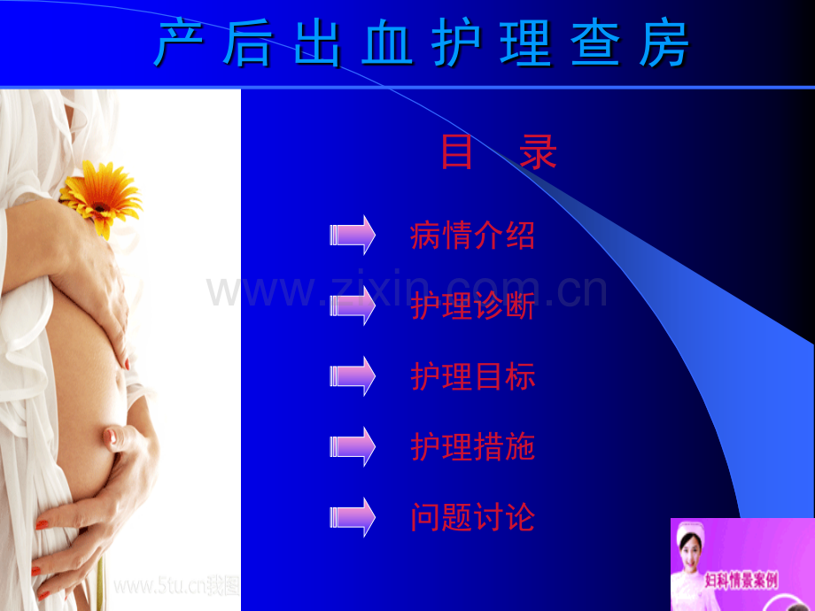 产后出血护理查房(新).ppt_第1页