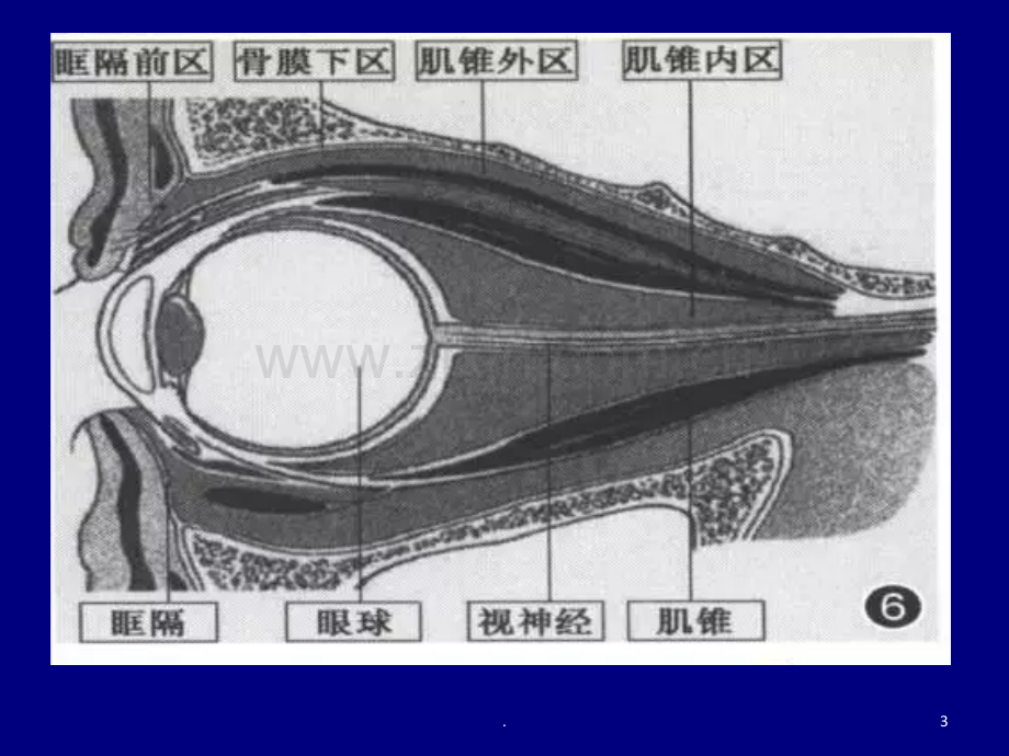 常见眼眶内肿瘤的影像诊断分析PPT课件.ppt_第3页