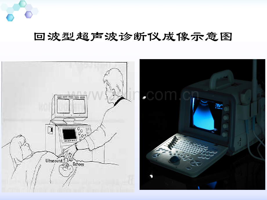 超声基础及临床应用.ppt_第2页