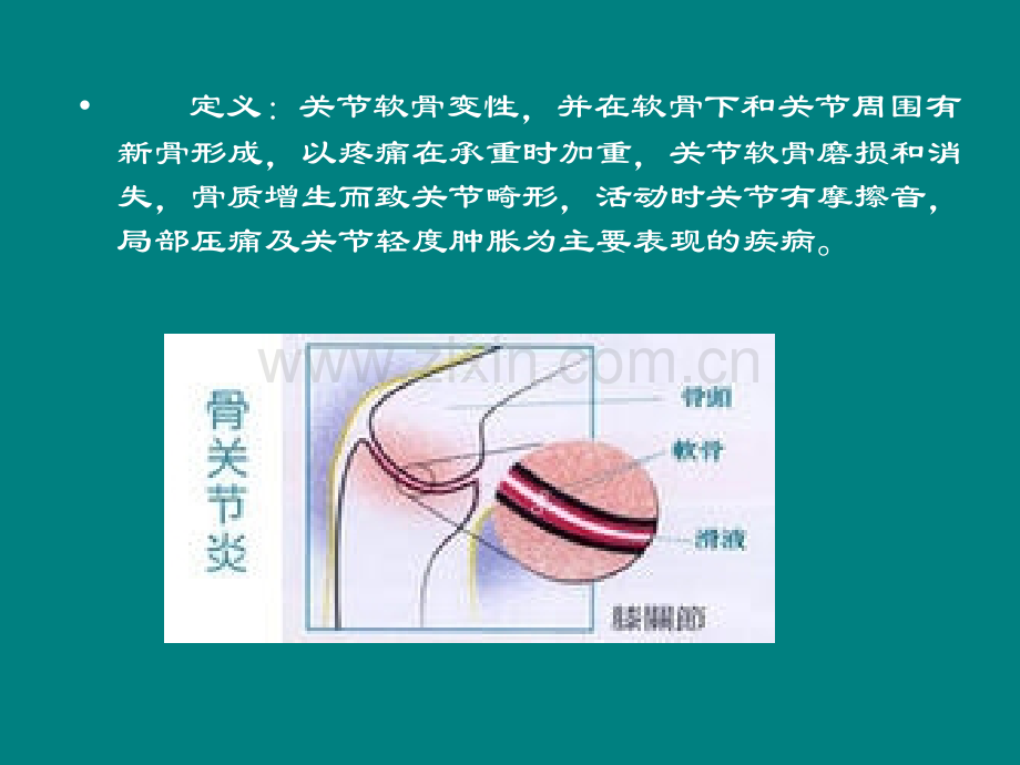 病理骨关节炎的体征ppt课件.ppt_第2页