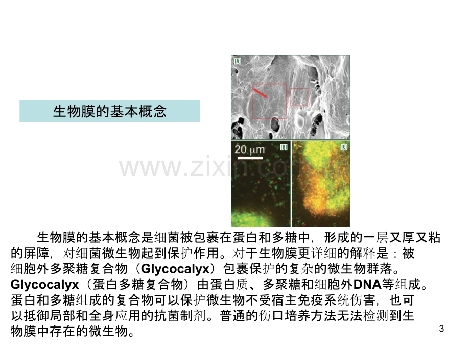 微动力负压普外科ppt课件.pptx_第3页