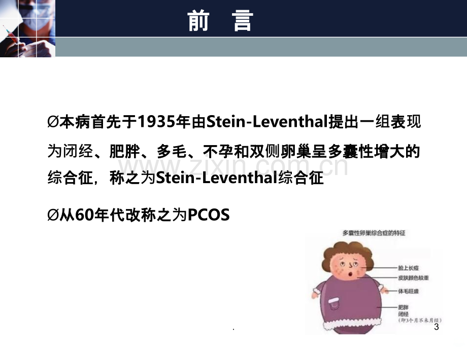 多囊卵巢综合征PPT课件.ppt_第3页