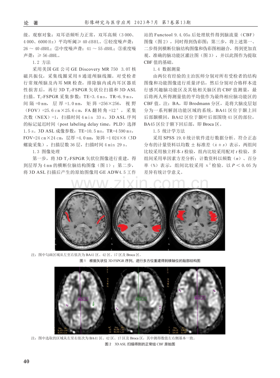 职业性噪声聋听觉中枢的动脉自旋标记MR研究.pdf_第2页