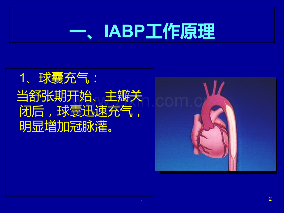 IABP使用常见问题PPT课件.ppt_第2页