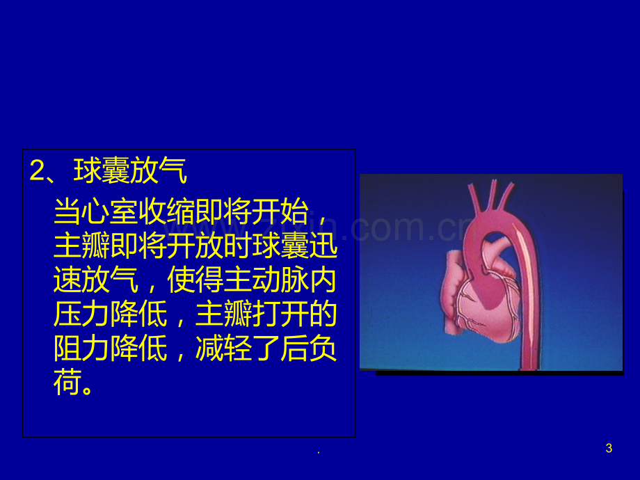 IABP使用常见问题PPT课件.ppt_第3页