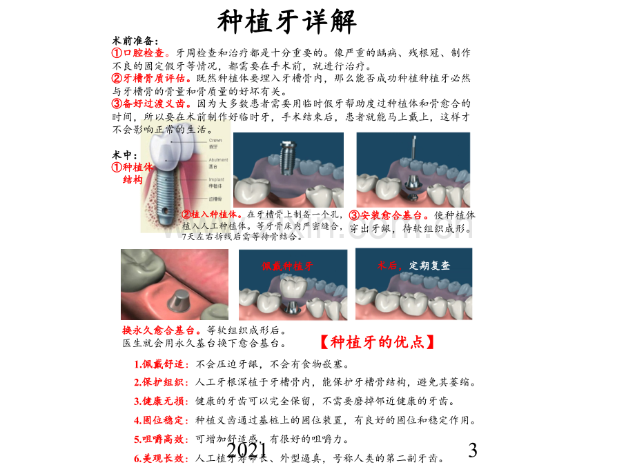 牙科项目详情手册PPT课件.pptx_第3页