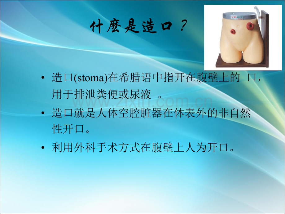 造口的分类.ppt_第2页