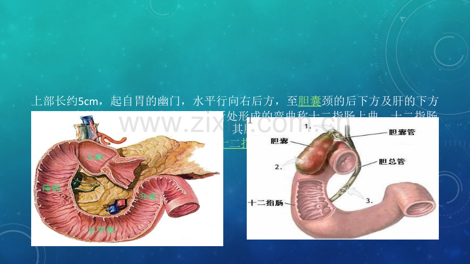 MRC对壶腹周围癌的诊断ppt课件.ppt_第3页