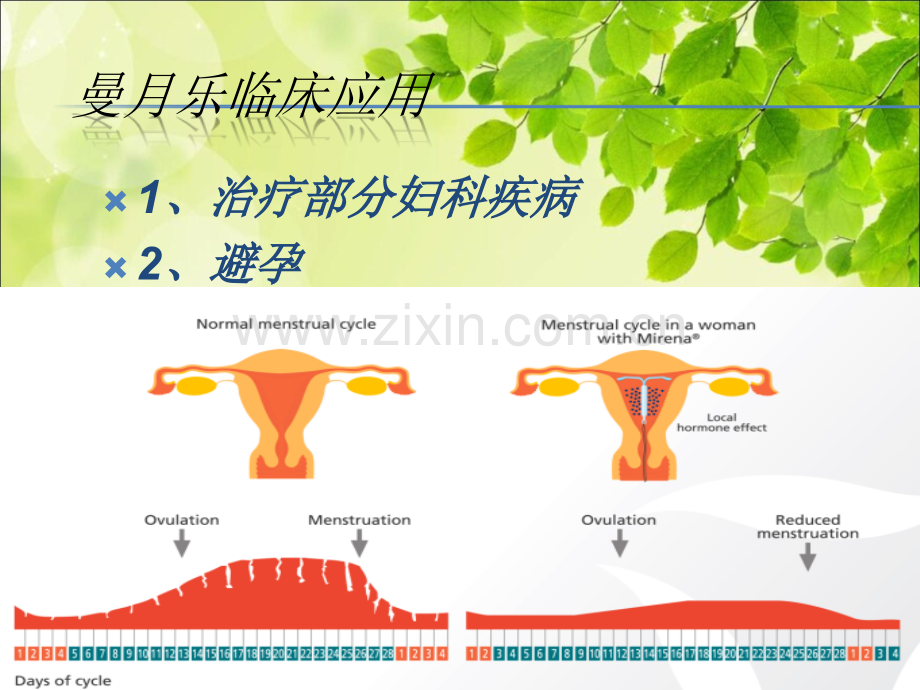 常青曼月乐临床应用ppt课件.ppt_第2页