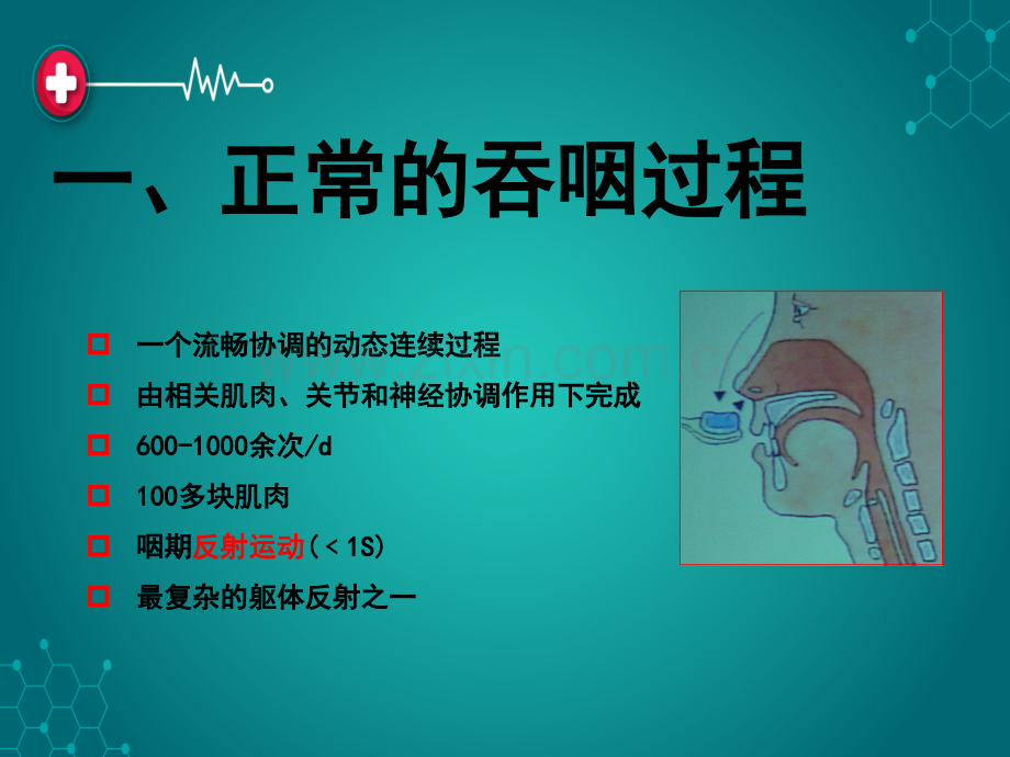 第十一章-吞咽障碍ppt课件.ppt_第2页