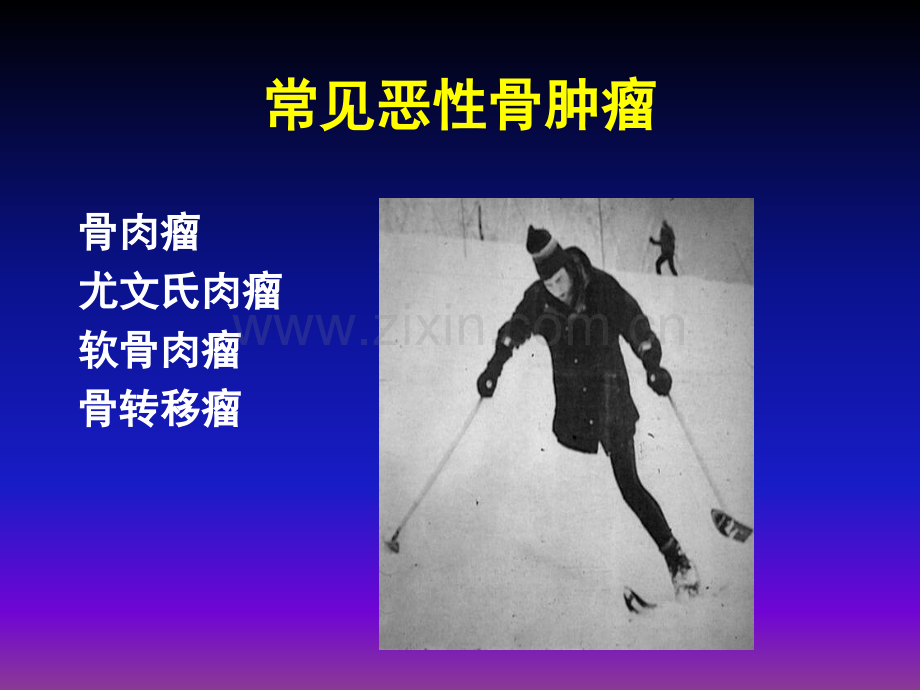 常见骨肿瘤影像诊断分析ppt课件.ppt_第2页