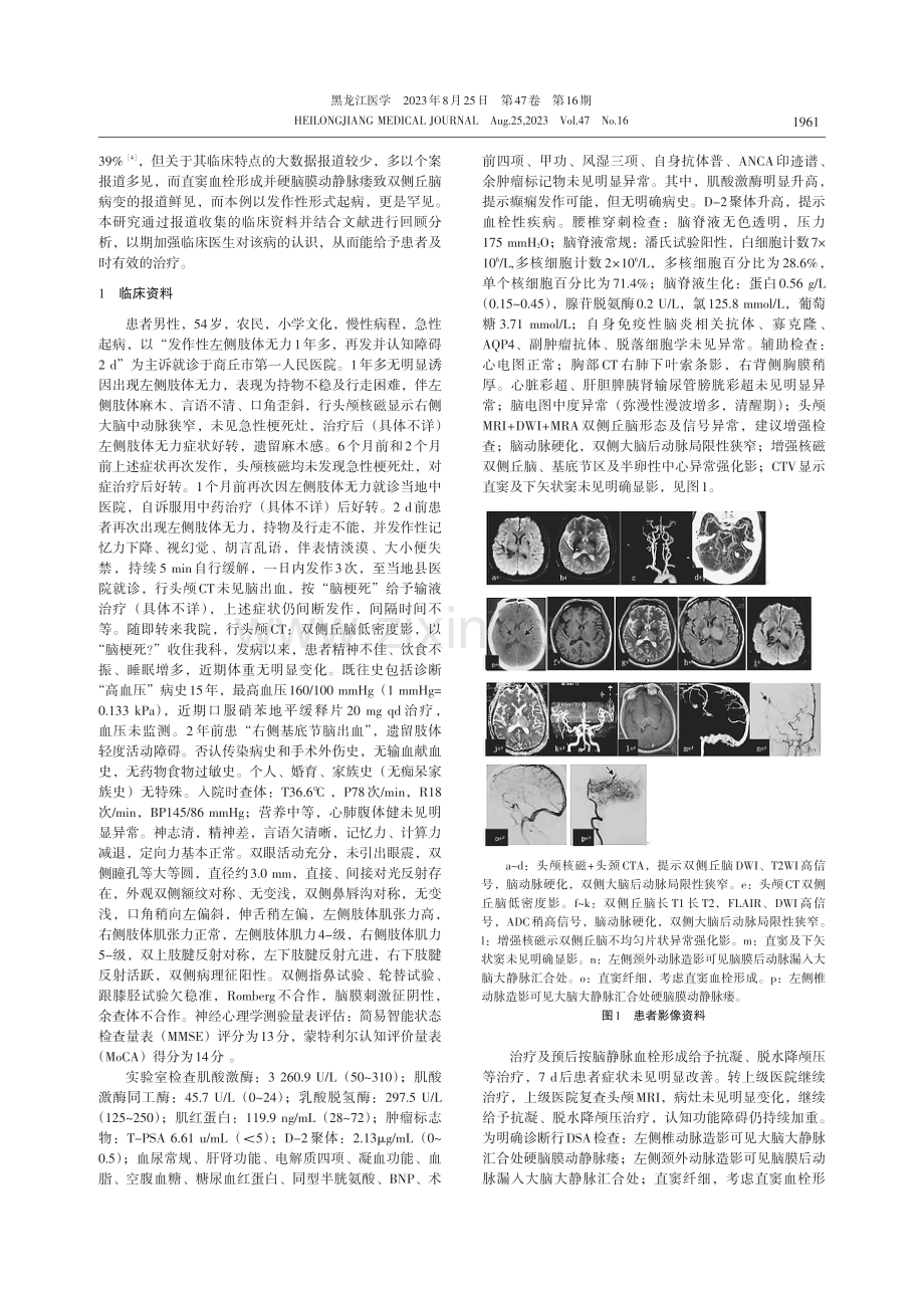 直窦血栓形成并硬脑膜动静脉瘘致双侧丘脑病变：附1例报告及文献分析.pdf_第2页