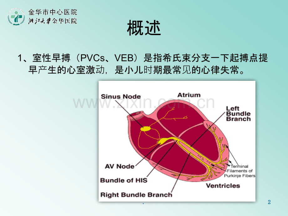 儿童室性早搏ppt课件.pptx_第2页