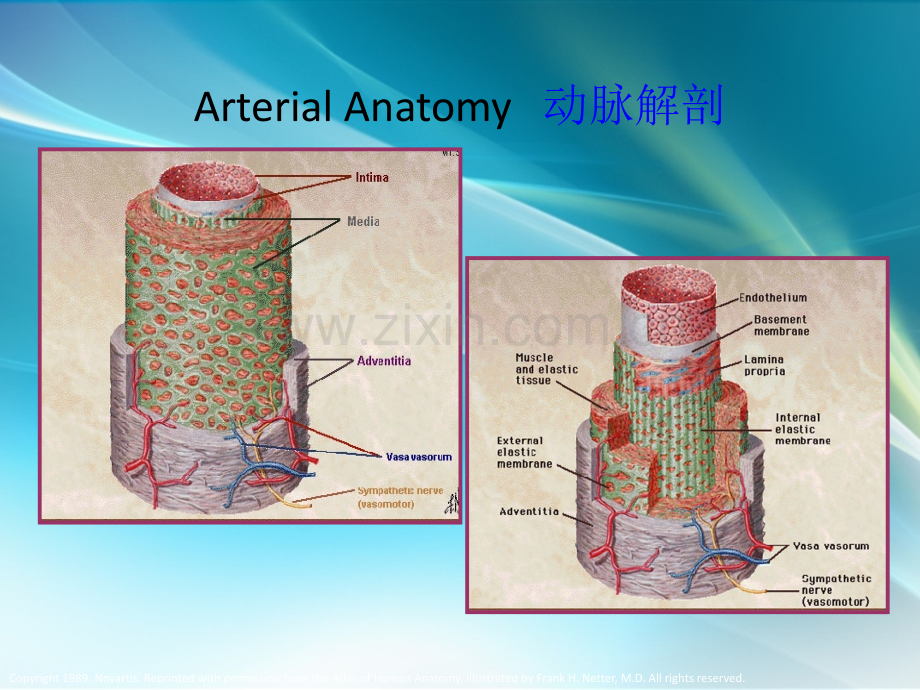 腹主动脉瘤之护理教学查房.ppt_第3页