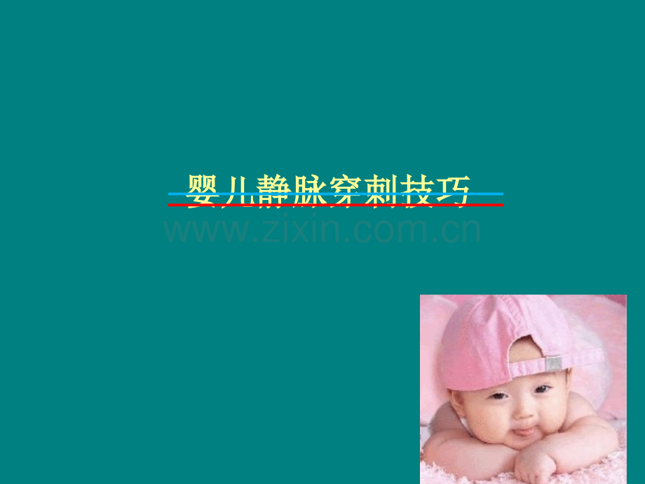 婴儿静脉穿刺技巧.ppt_第1页