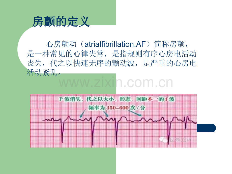 房颤治疗策略.ppt_第2页