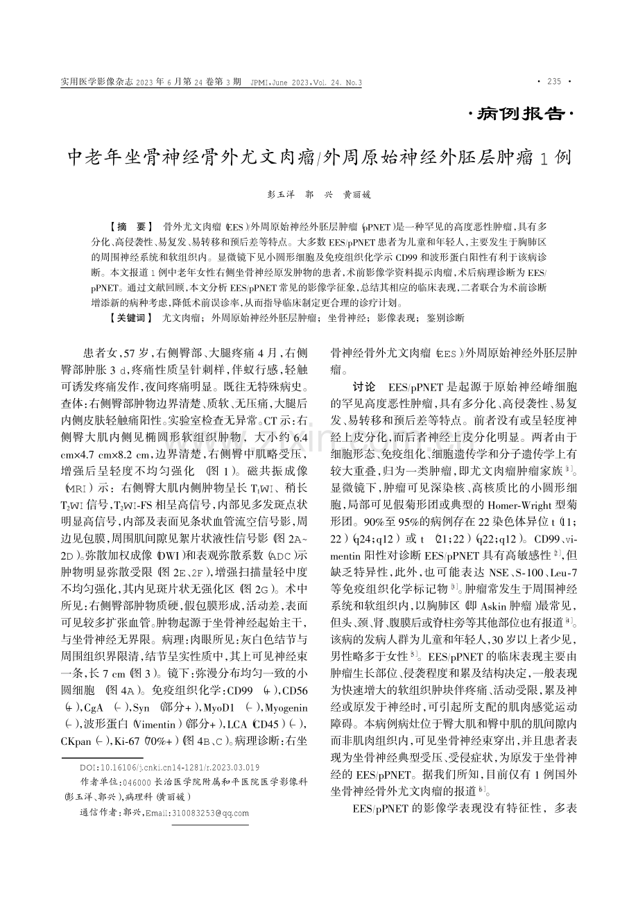 中老年坐骨神经骨外尤文肉瘤_外周原始神经外胚层肿瘤1例.pdf_第1页