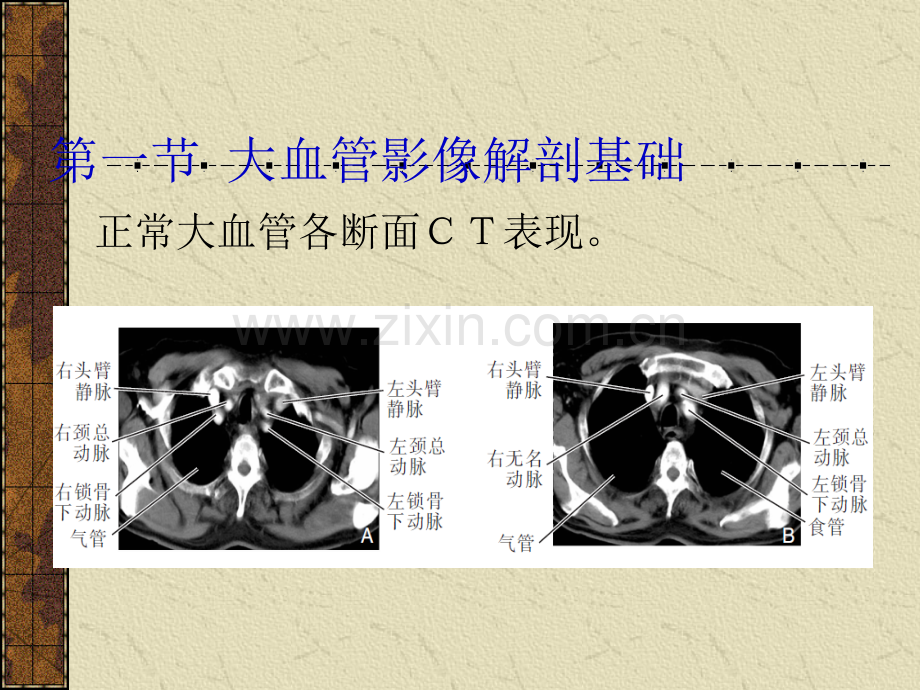 第十一章-血管.ppt_第2页