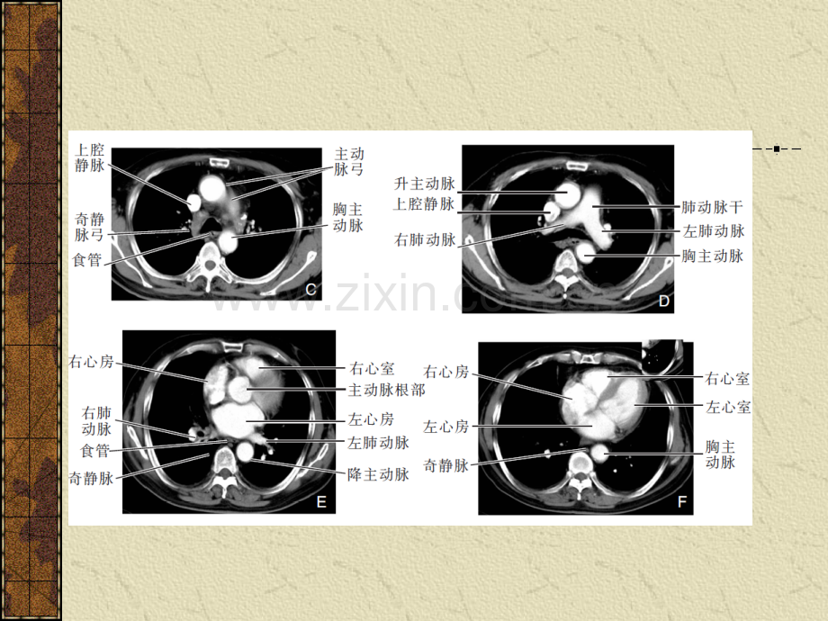 第十一章-血管.ppt_第3页