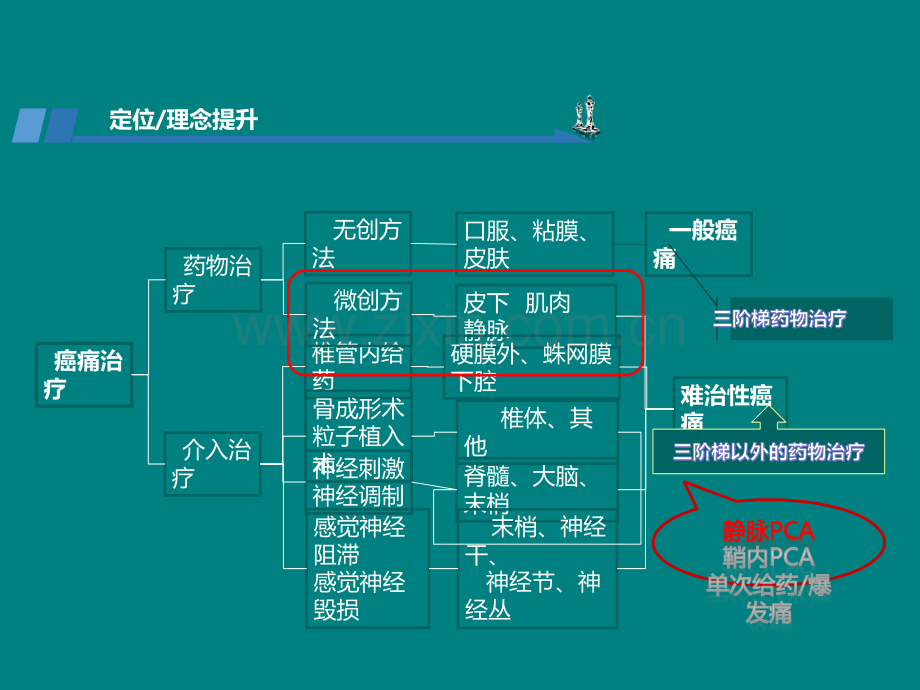 PCA镇痛技术在难治性癌痛治疗中的应用.ppt_第3页