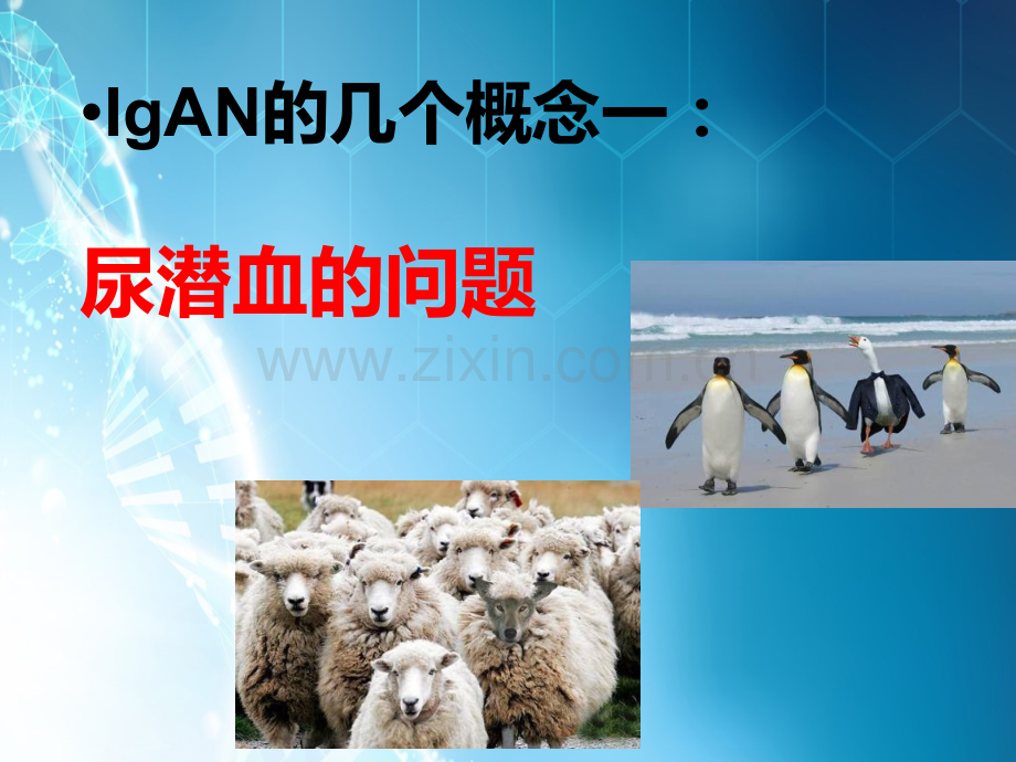 IgA肾病免疫治疗ppt课件.ppt_第3页