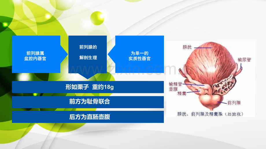 腹腔镜下前列腺癌ppt课件.ppt_第3页