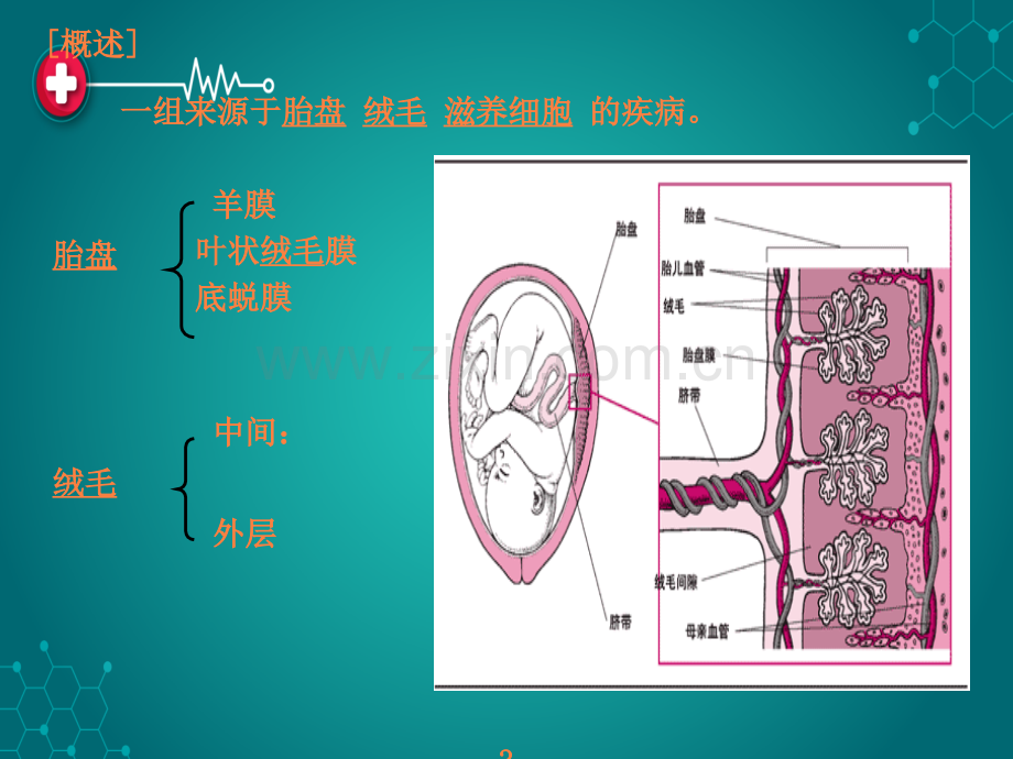 第七版-妊娠滋养细胞疾病ppt课件.ppt_第3页