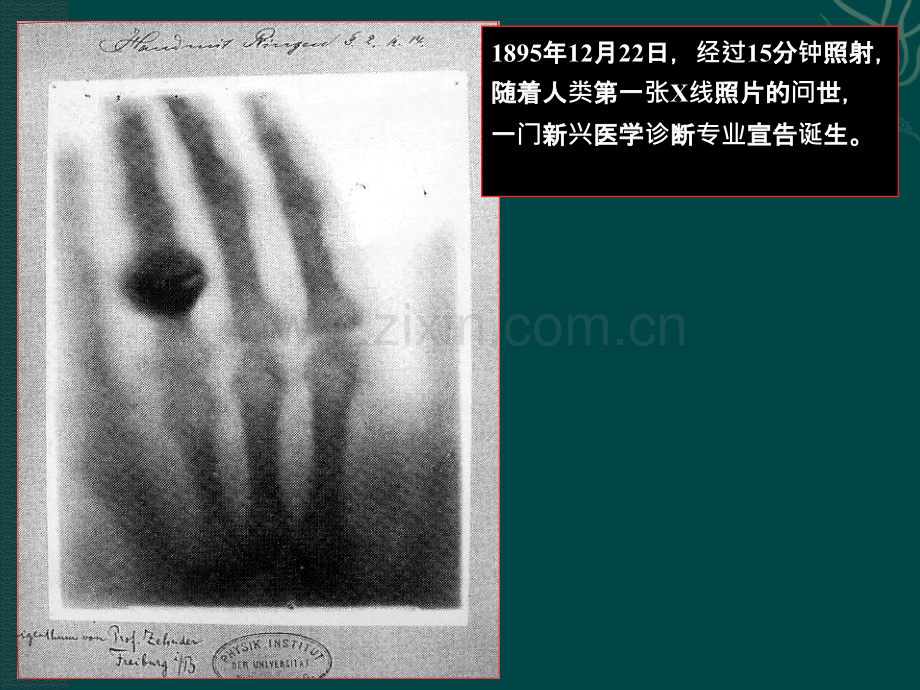 X线诊断学概要骨关节及呼吸系统X线诊断ppt课件.ppt_第3页