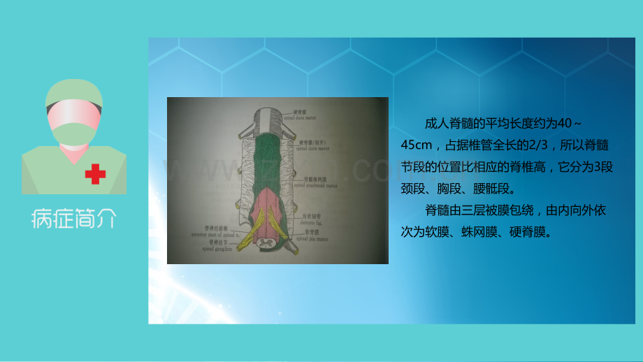 椎管内占位ppt课件.pptx_第3页