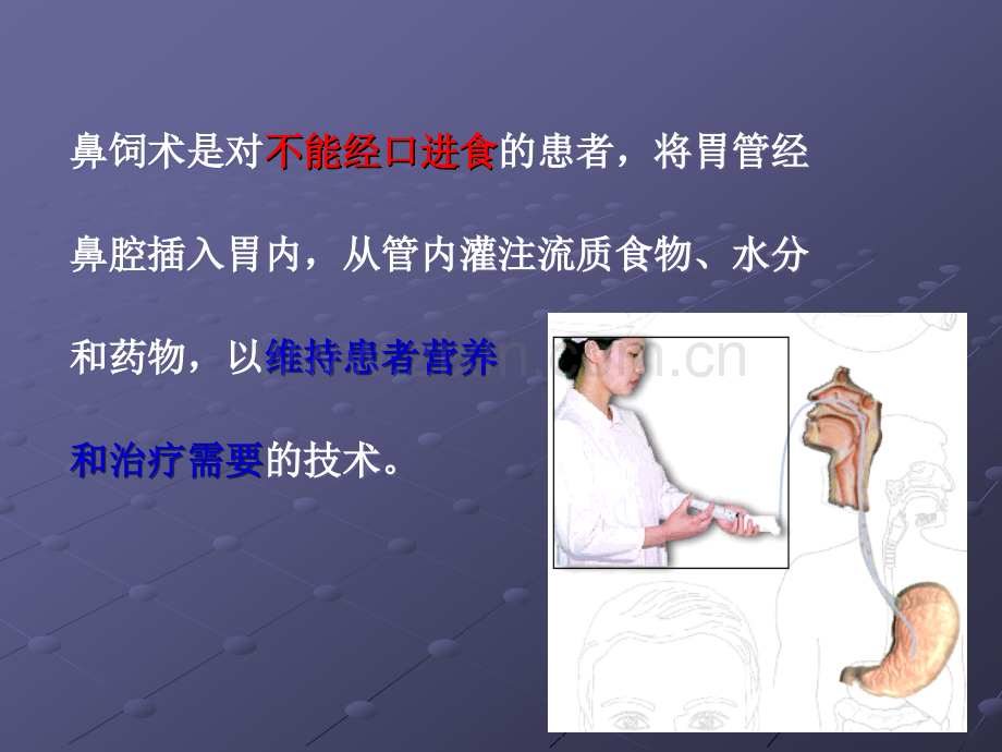 鼻饲、灌肠、导尿术ppt课件.ppt_第2页