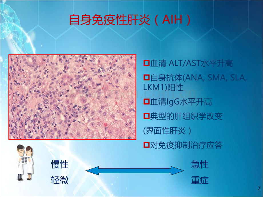 自身免疫性肝炎诊治.ppt_第2页