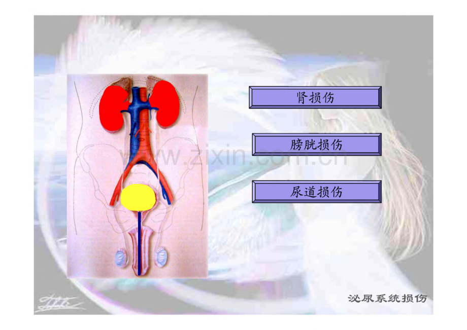 泌尿系统损伤病人的护理.pdf_第2页