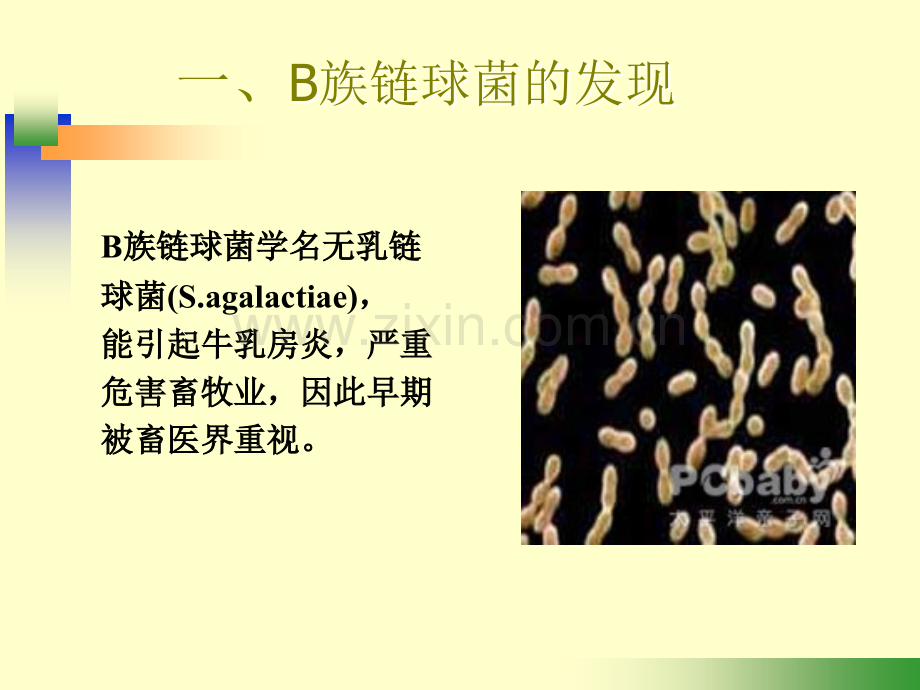 B族链球菌的检测意义.ppt_第3页