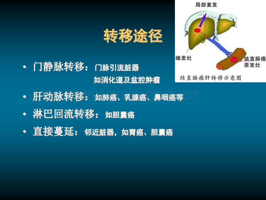 肝转移瘤的影像诊断和鉴别诊断.ppt_第3页