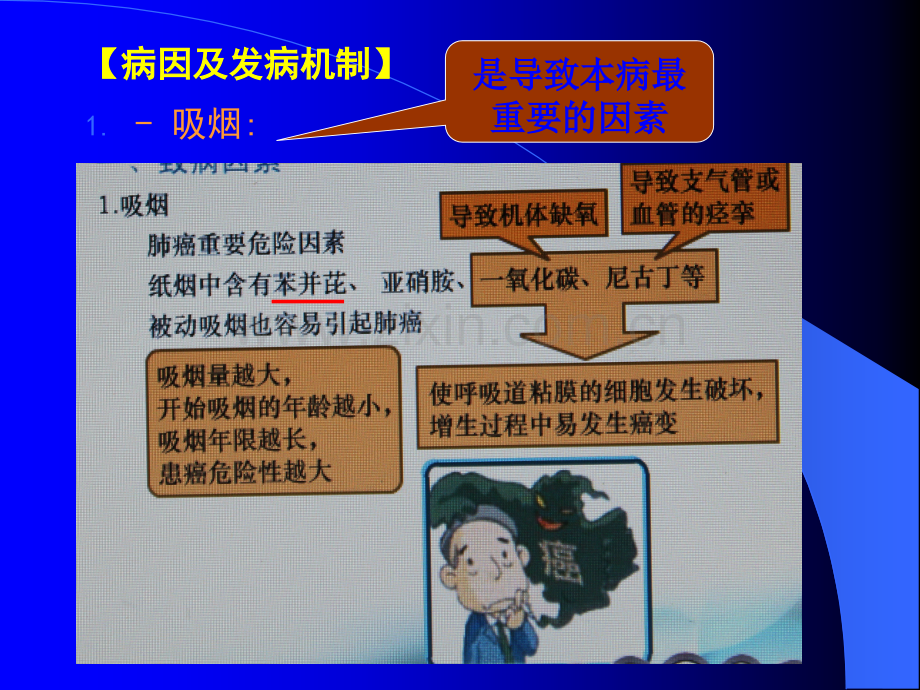 第二章第十节--原发性支气管肺癌病人的护理ppt课件.ppt_第3页