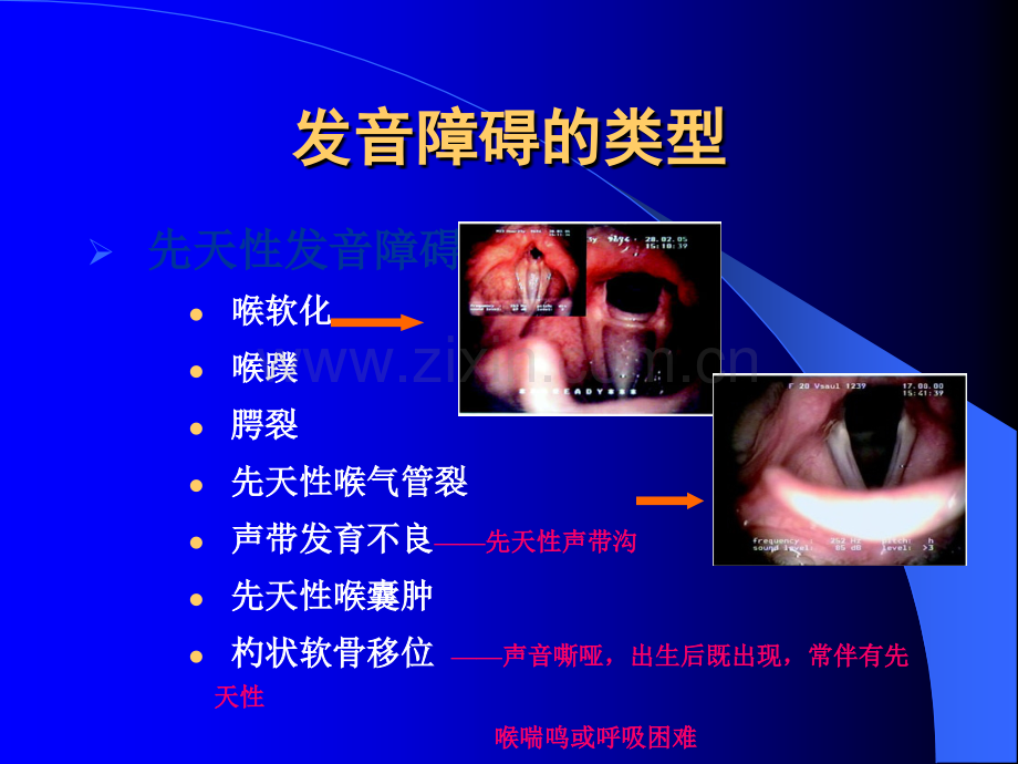 发音障碍的诊断与治疗ppt课件.ppt_第2页