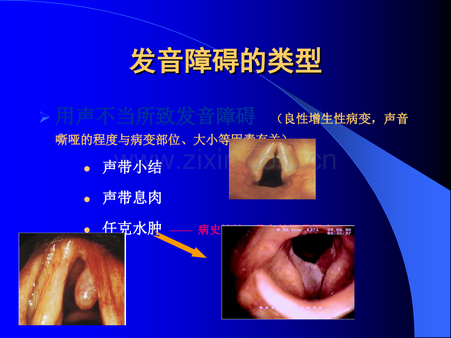 发音障碍的诊断与治疗ppt课件.ppt_第3页