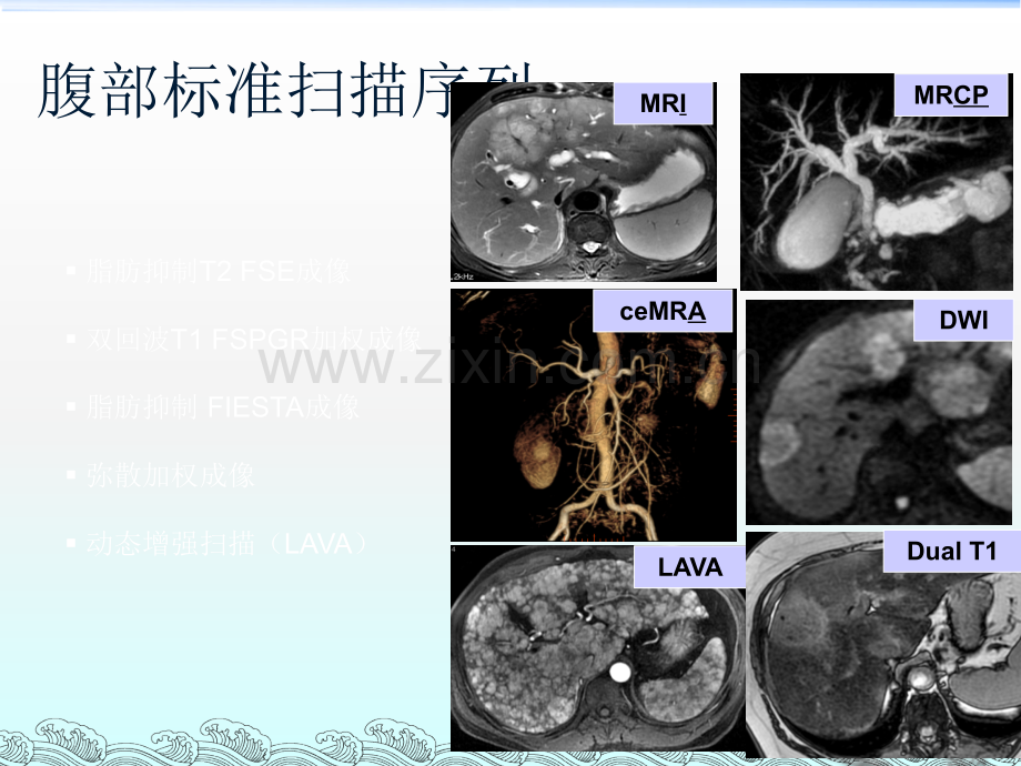 MRI在腹部疾病中的应用ppt课件.ppt_第3页