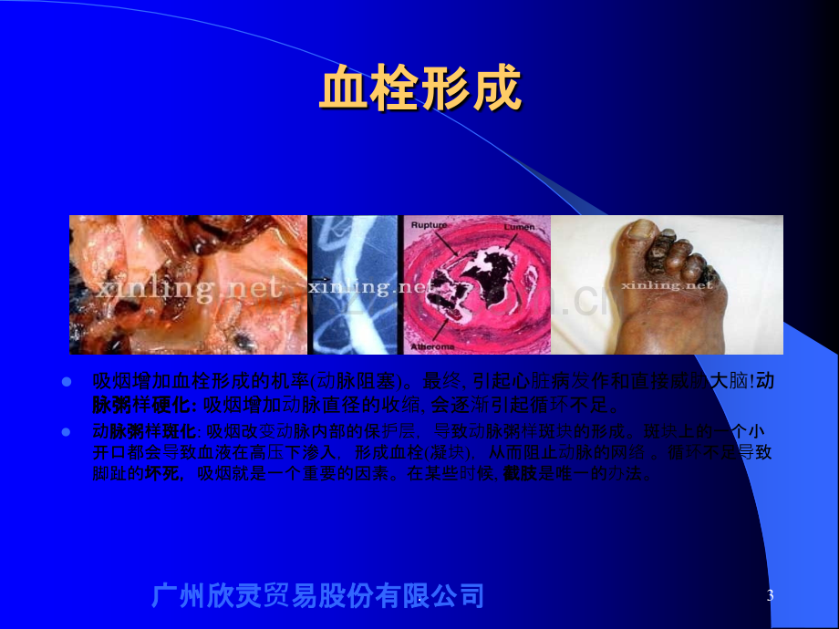 吸烟有害健康.ppt_第3页