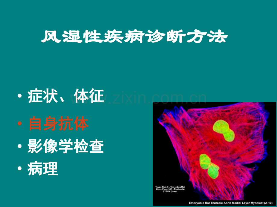 风湿性疾病中自身抗体的意义.ppt_第2页