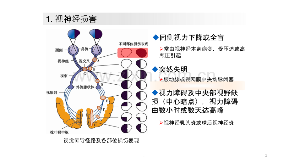 西综医学考试版ppt课件.pptx_第3页