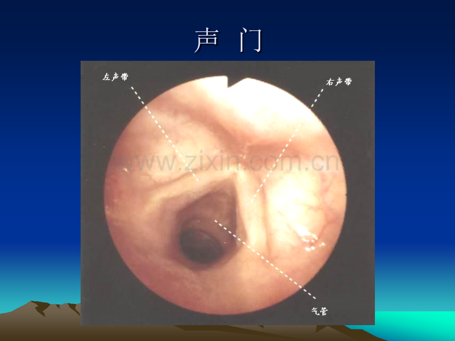 纤维支气管镜解剖.ppt_第3页