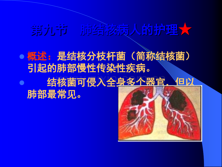 第二章科贸学院内科护理(第九节肺结核病人护理)ppt课件.ppt_第2页