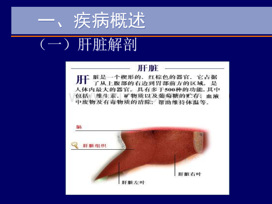 原发性肝癌介入护理ppt课件.ppt_第3页