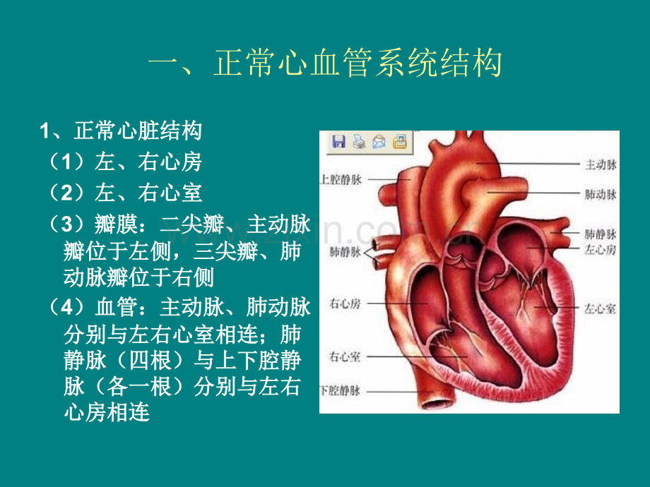 常见先天性心脏病ppt课件.ppt_第2页