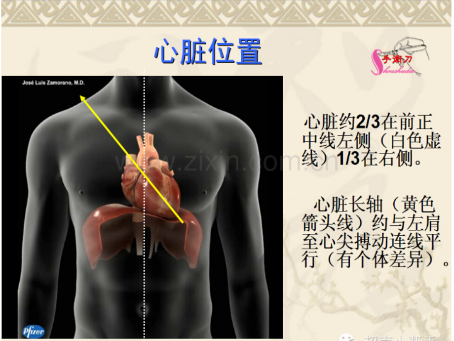 心脏彩超技巧ppt课件.pptx_第2页