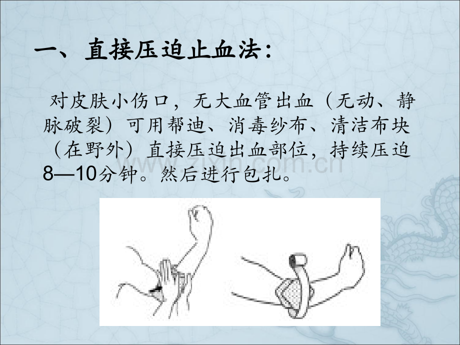 现场急救常识二：局部压迫止血法.ppt_第3页